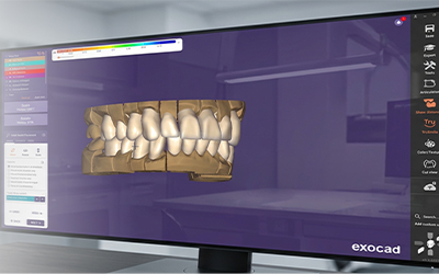 Exocad & CAD/CAM Systems